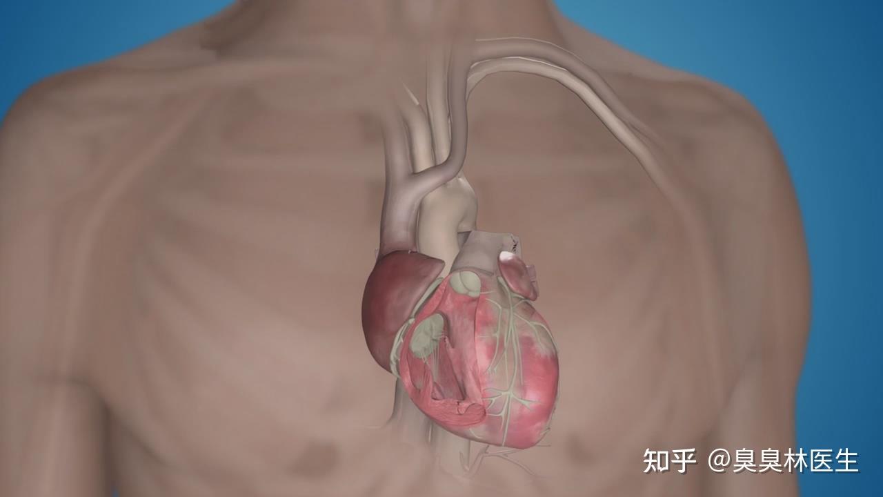 新版心脏起搏器国家标准发布
