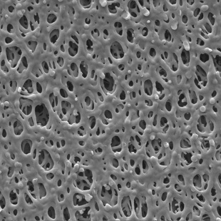 三鑫医疗获得实用新型专利授权:“一种可制备变径的膨体聚四氟乙烯管膜的装置”