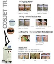 帝尔激光获得发明专利授权：“一种光斑旋转补偿激光加工方法及系统”