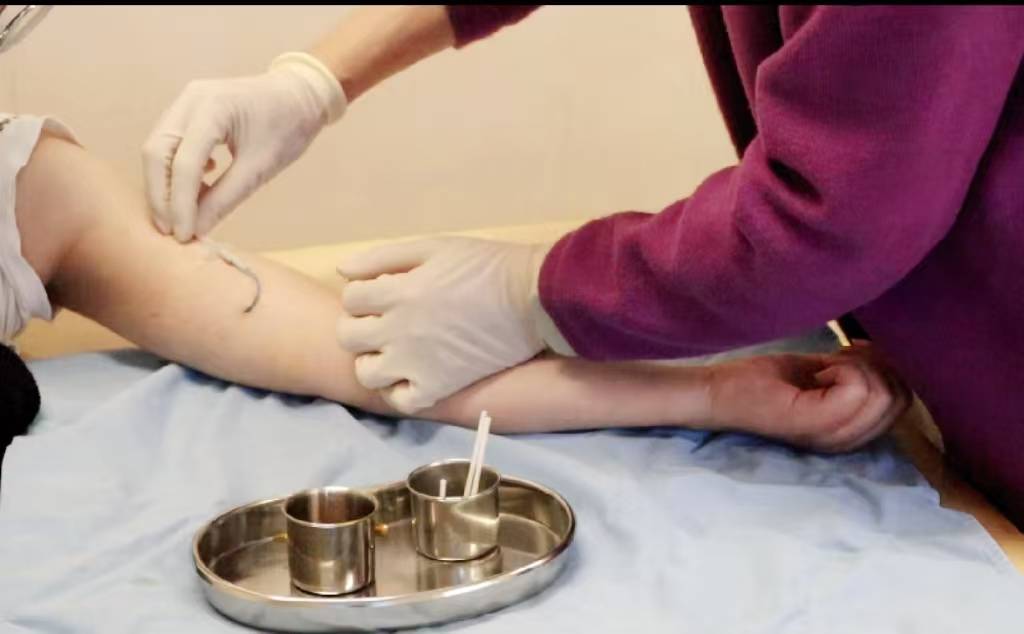 新华鲜报丨手术机器人收费有了“国家标准”！