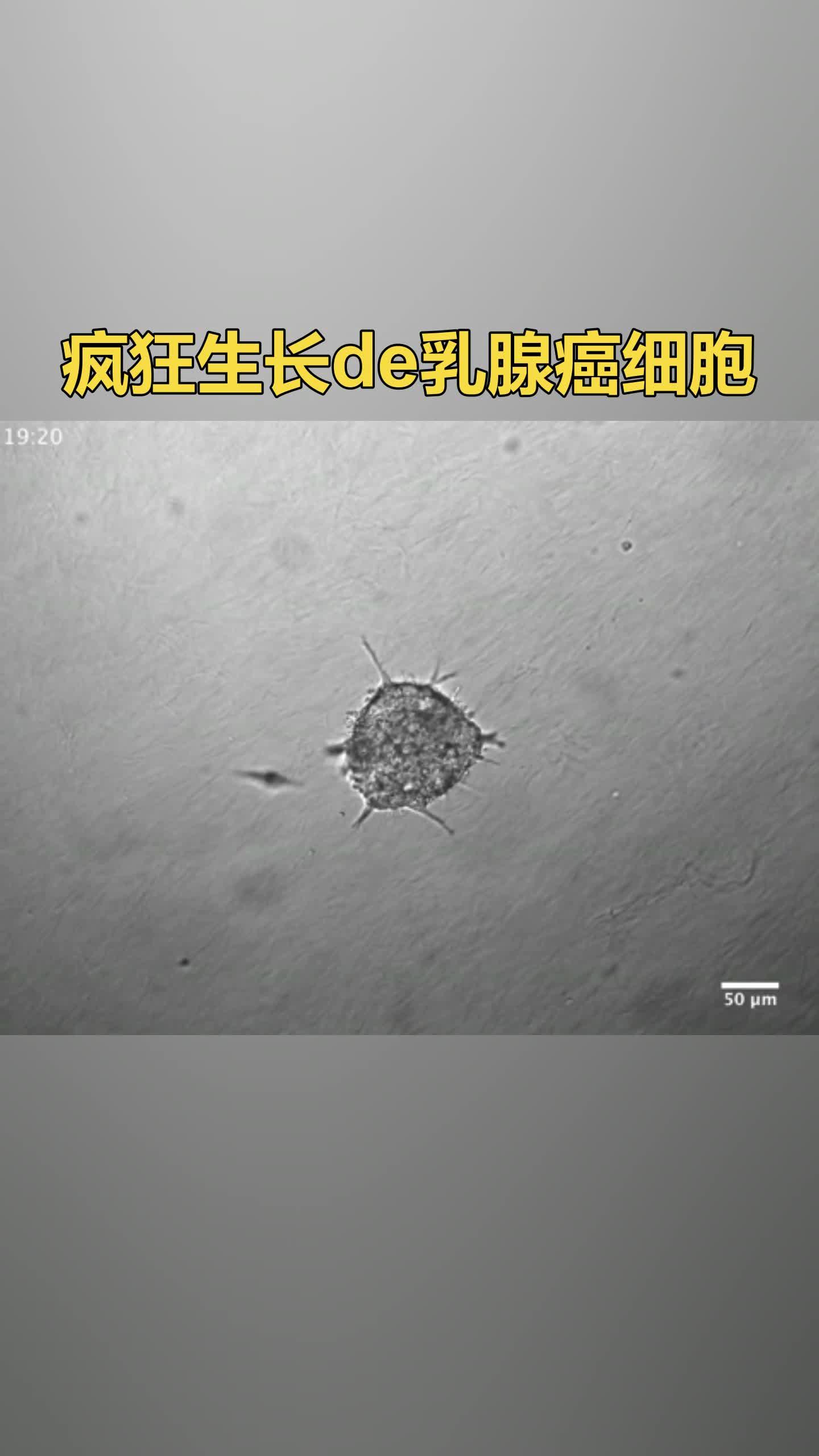 迈瑞医疗获得发明专利授权:“乳腺超声图像分割方法及设备”
