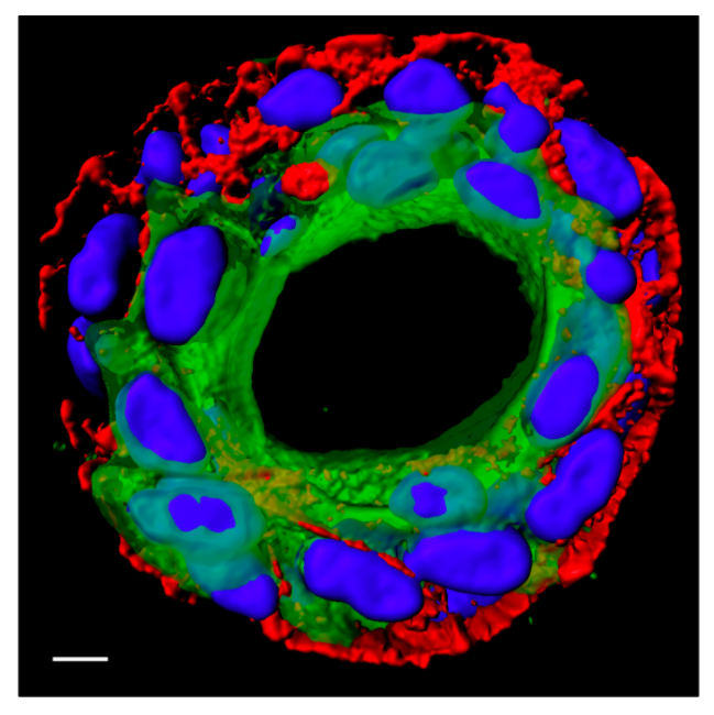 迈瑞医疗获得发明专利授权:“乳腺超声图像分割方法及设备”